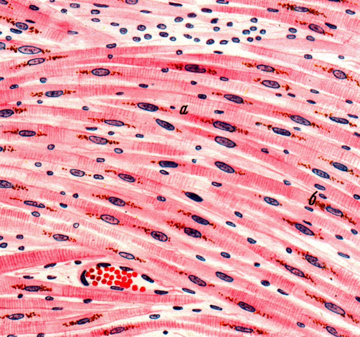 Сердечная мышечная ткань рисунок. Гладкая мышечная ткань микропрепарат. Гладкомышечная клетка гистология. Бурая атрофия миокарда микропрепарат. Клетки мышечной ткани гистология.