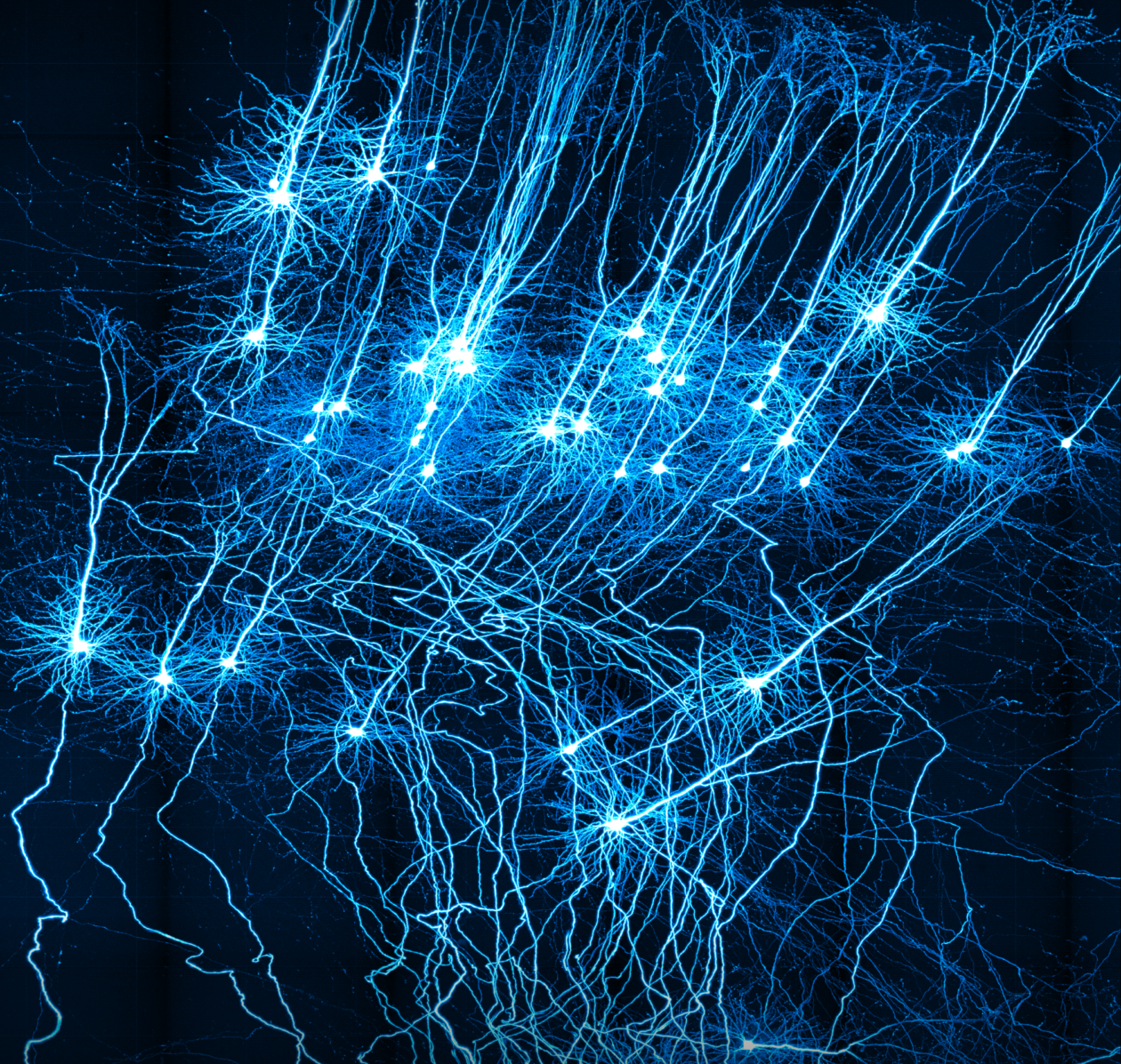 Нейронная сеть создает изображение. Нейронные клетки головного мозга. Нейрон в нейронной сети. Нейросеть Нейроны. Нейронные сети картинки.