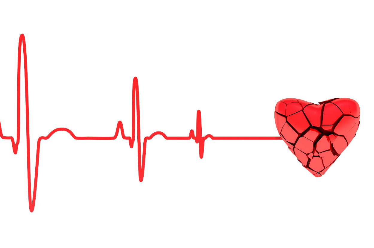 Сердцебиение остановилось. Кардиограмма сердца. Кардиограмма остановки сердца. Остановка сердца на ЭКГ. Линия кардиограммы.